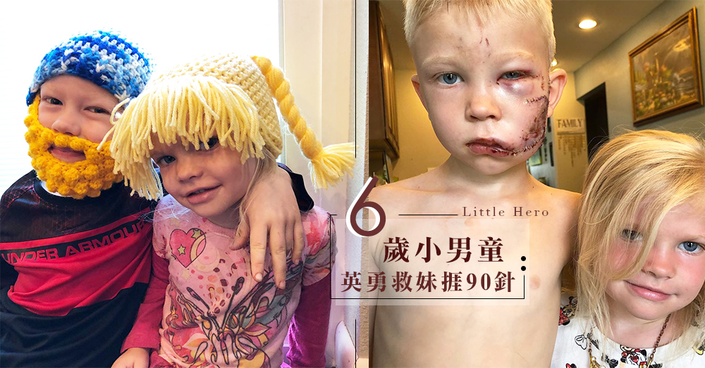 「如果真的有人要死，那也是我死！」6歲小哥哥為救被狗攻擊的妹妹，受傷捱痛縫上90針，哥哥的愛好強大！